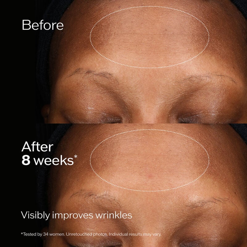 Total Regenerating Cream, 