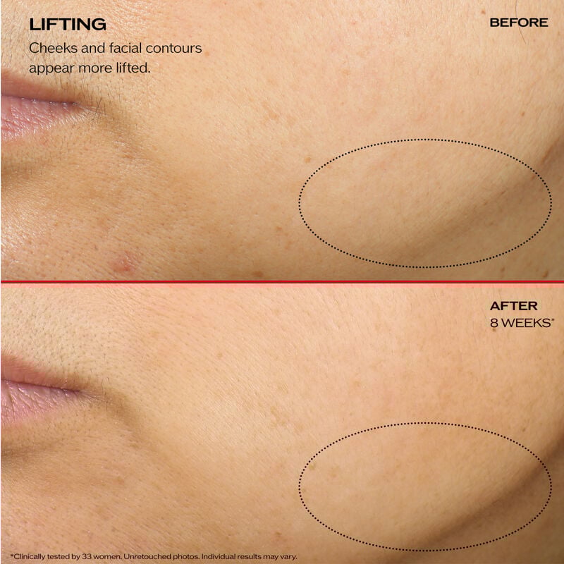 Uplifting and Firming Advanced Cream, 