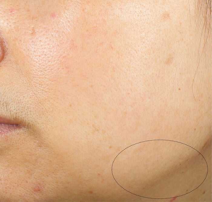 Uplifting and Firming Advanced Cream, 